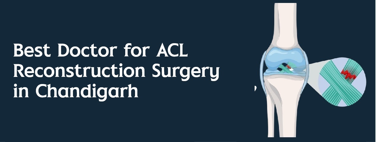 Best Arthroscopy Specialist In Panchkula, Chandigarh Haryana