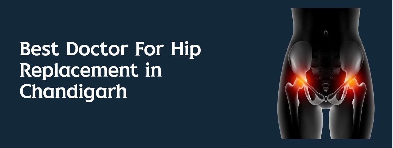 Best Doctor For Hip Replacement in Panchkula, Chandigarh Haryana