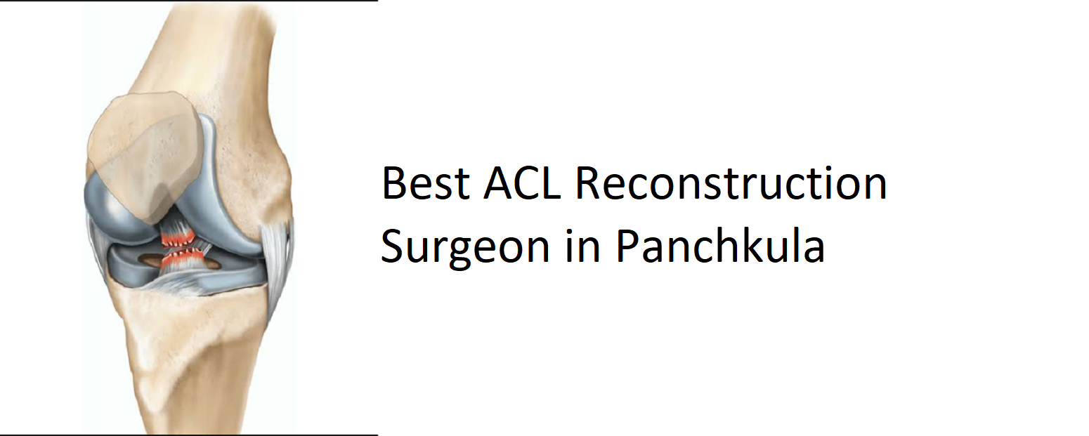 Best Arthroscopy Specialist In Panchkula