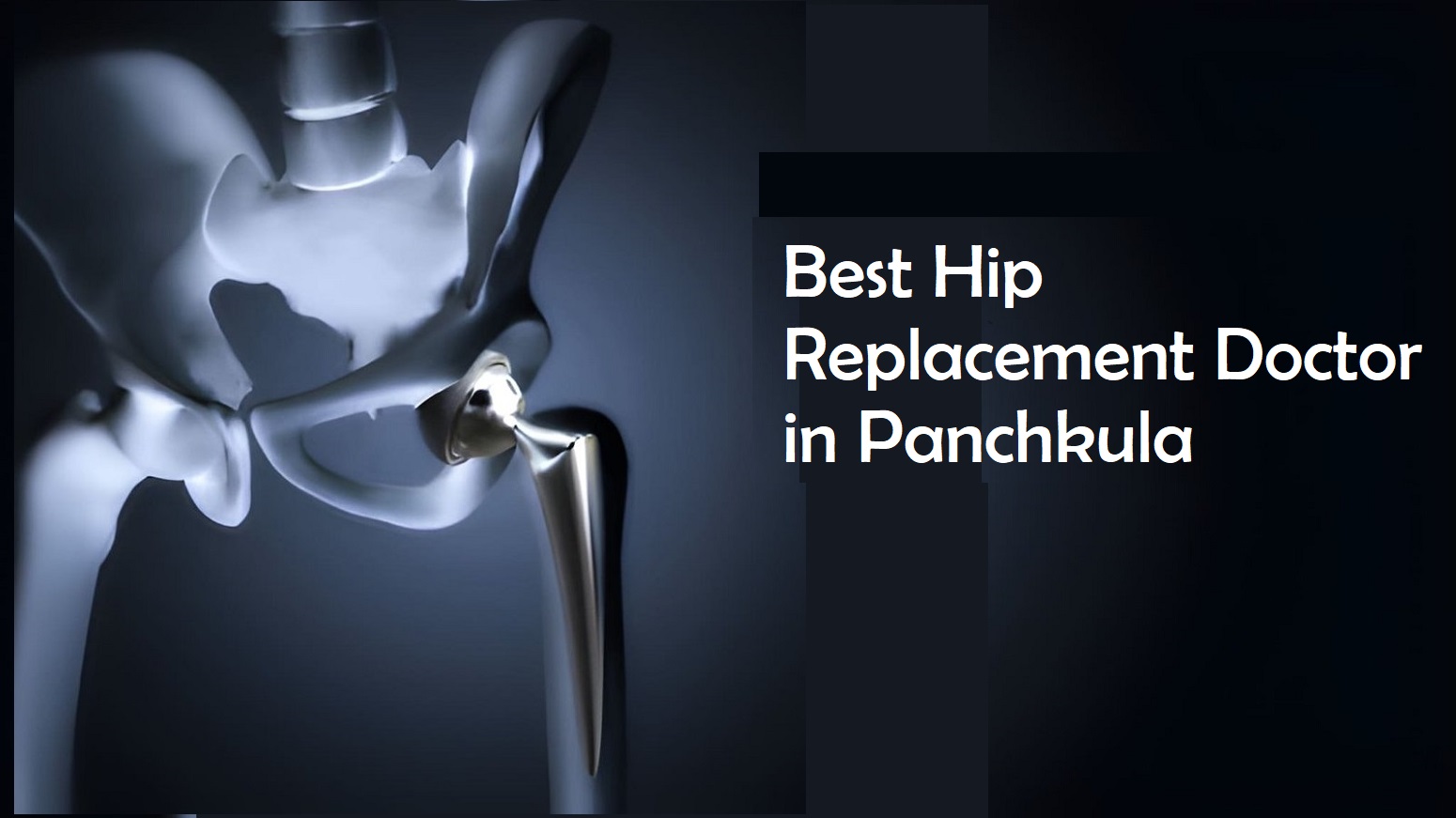 Best Hip Replacement Doctor in Panchkula 
