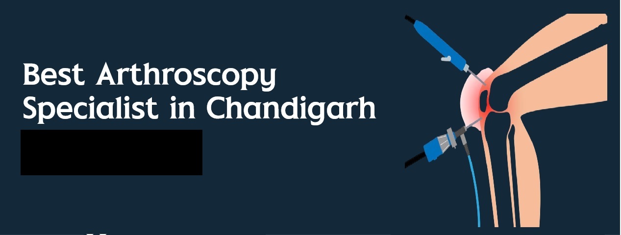 Best Arthroscopy Specialist In Panchkula, Chandigarh Haryana